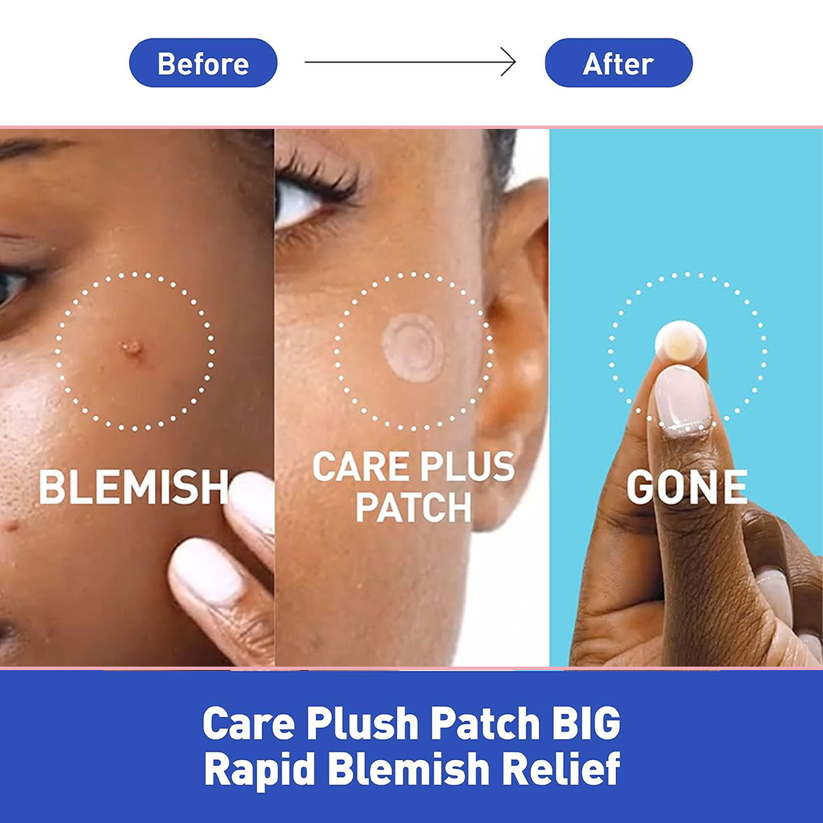 โอลีฟ ยัง แคร์ พลัส สปอต คัฟเว - Skincare Moisturizer บทวิจารณ์และราคา