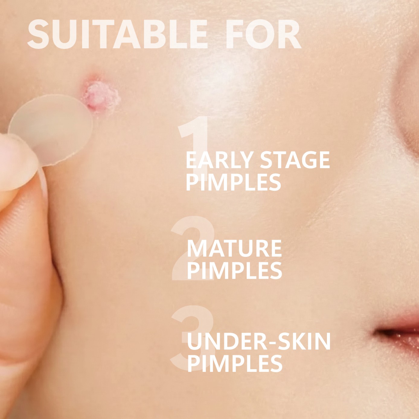 แผ่นแปะสิวไมโครนีดเดิล (24 แพ็ - Skincare Moisturizer บทวิจารณ์และราคา